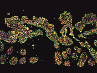 Immunofluoreszenzfärbung eines dynamisch kultivierten Lungentumormodells. 
