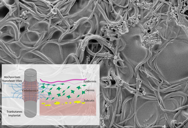 TOPS: Besiedelung des Fasermaterials mit Hautzellen