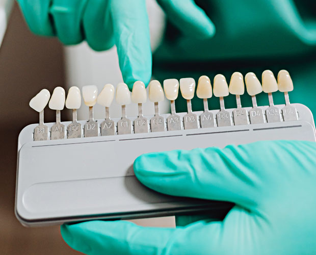 BioDent Biomimetic Dental Restoration
