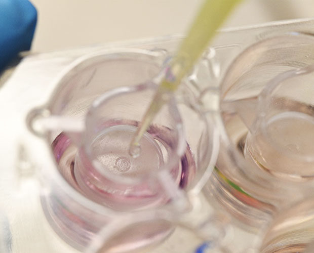 Tissue Engineering menschlicher Organmodelle Tissue Engineering menschlicher Organmodelle