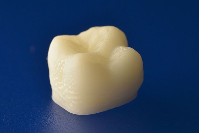 ORMOCER®-basierte Materialien können mit 3D-Druck zu beliebigen komplexen Formen mit Hinterschneidungen und filigranen Strukturen verarbeitet werden. Zudem lassen sich ebenfalls hochwertige dentale Komposite verdrucken.