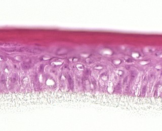 Menschliche Epidermins