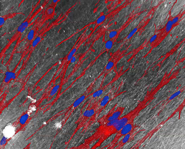 ScarCare: Fibroblasten