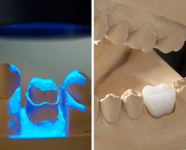 Additive manufacturing with ORMOCER®
