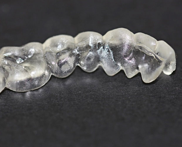3D-printed teeth straightening splint