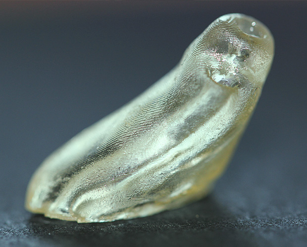 ORMOCER® material system Thermoeffect Otoplasty