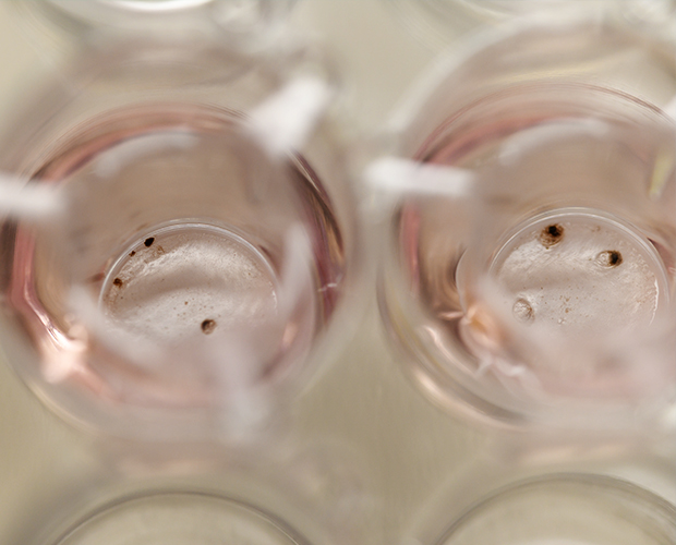 In-vitro Tumor In-vitro Tumor